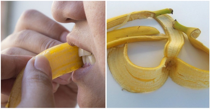 Зубы после чистки нужно протереть банановой кожурой