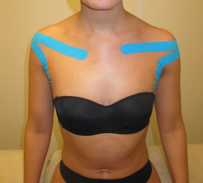 Обычно тейпы используют для фиксации груди