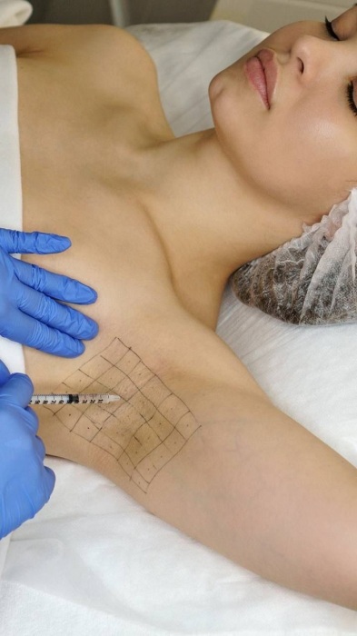 Перед процедурой делают специальную разметку