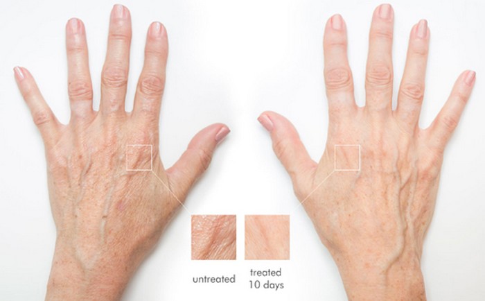 7 секретов ухода за кожей рук, которые продлят их молодость на долгие годы