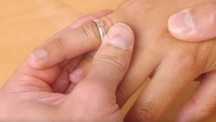 Как снять кольцо, если оно застряло на пальце