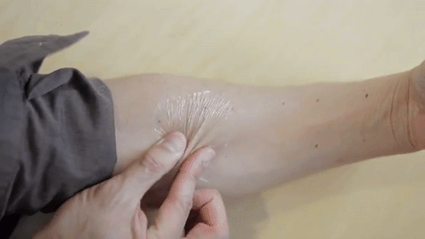 Учёные разработали «вторую кожу» - самое эффективное средство против морщин на сегодня
