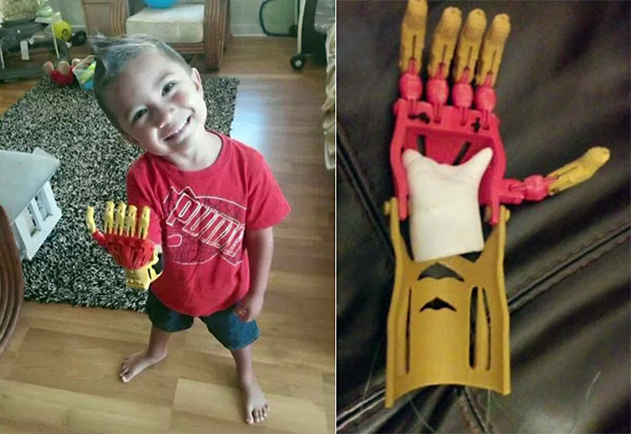 Детский протез рука Железного человека распечатан на 3D-принтере