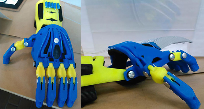 Детский протез в виде руки Росомахи распечатан на 3D-принтере