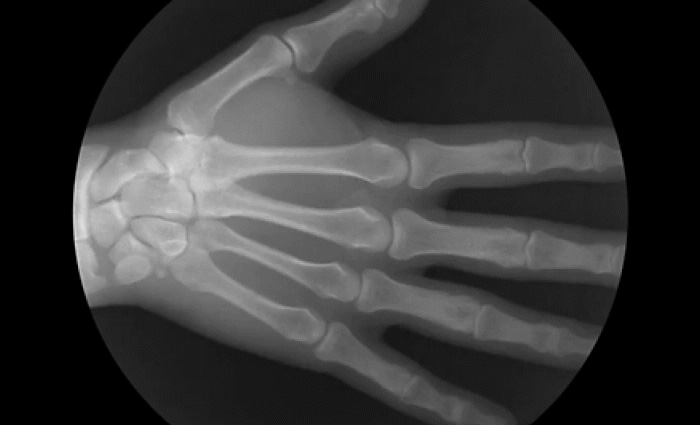 Удивительные гифки рентгеновских снимков, демонстрирующие движения костей человека