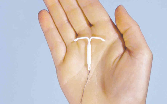  Мирена – контрацептивная внутриматочная спираль 