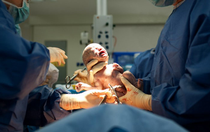 Трансплантация матки