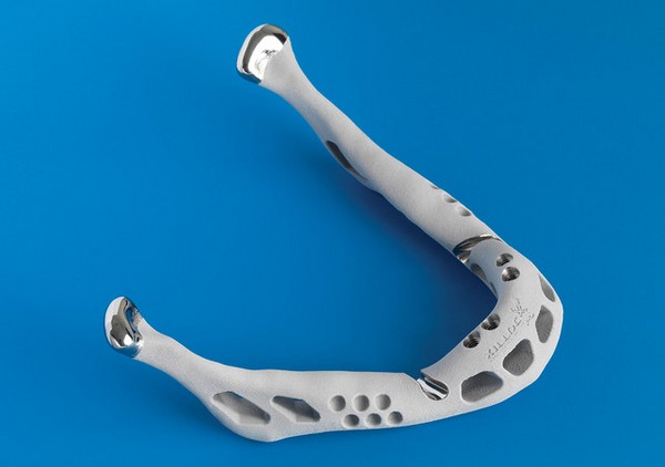 Напечатанная на 3D-принтере вставная челюсть
