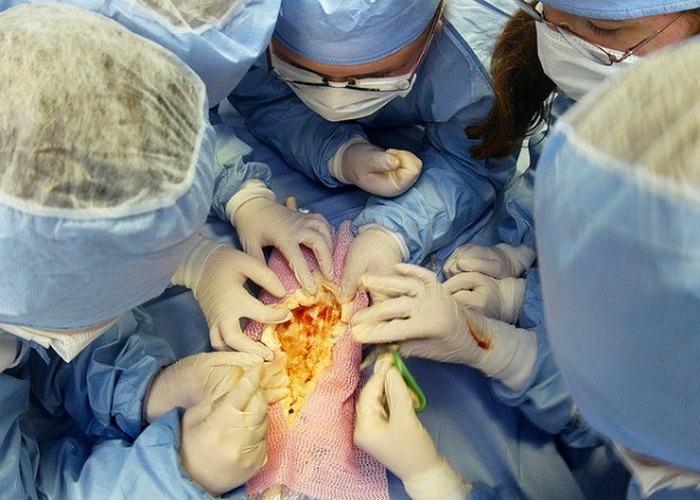  Пациенты, которые утверждали, что их личность изменилась после трансплантации органов.