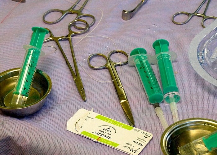 Хирургические инструменты, забытые врачами, внутри пациентов.