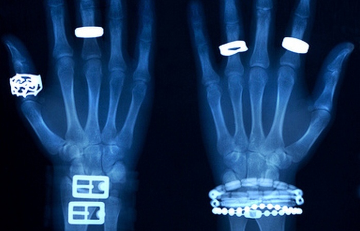 Рентген - способ определить подлинность.