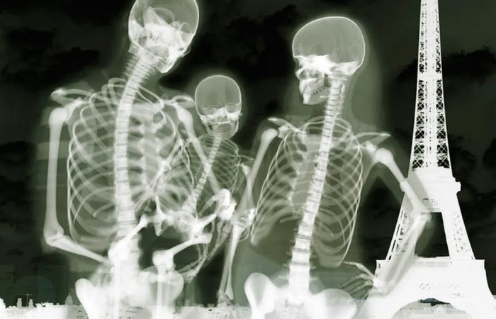 Ложный прогноз о рентгеновских лучах.