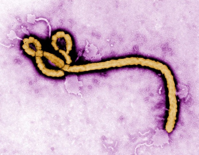 Страшный вирус Эбола.