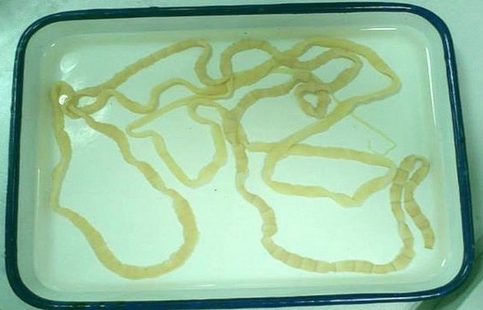 Бредовый метод похудения: поедание живых ленточных червей.