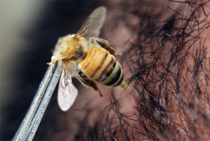 Пчелинные укусы как лекарство.