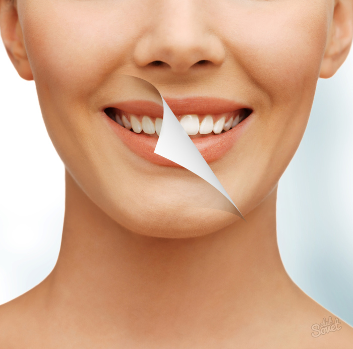 Обычной пищевой содой можно отбелить зубы без ущерба для зубной эмали.
