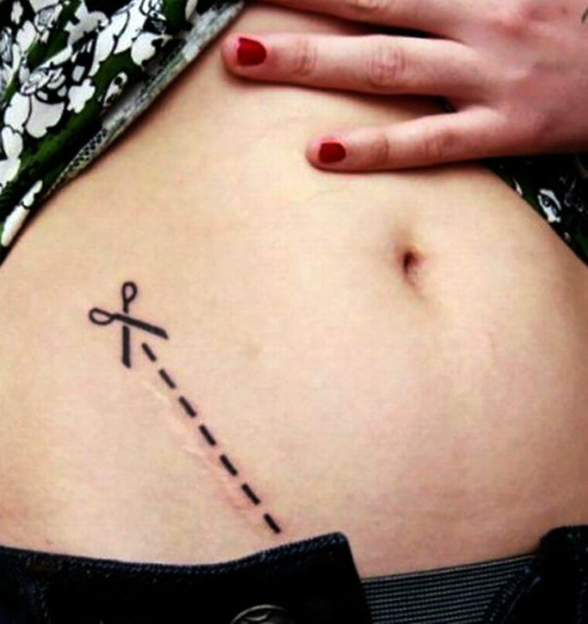 Татуировка с изображением ножниц и пунктирной линии разреза.