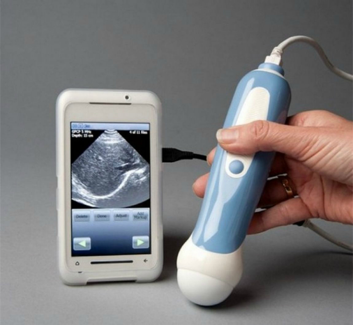 Личный аппарат УЗИ, который подключается к планшету или смартфону и выводит изображение на экран. С помощью этого аппарата можно увидеть плод в утробе матери, а также сделать сканирования сердца, легких, печени, желчного пузыря и молочных желез.