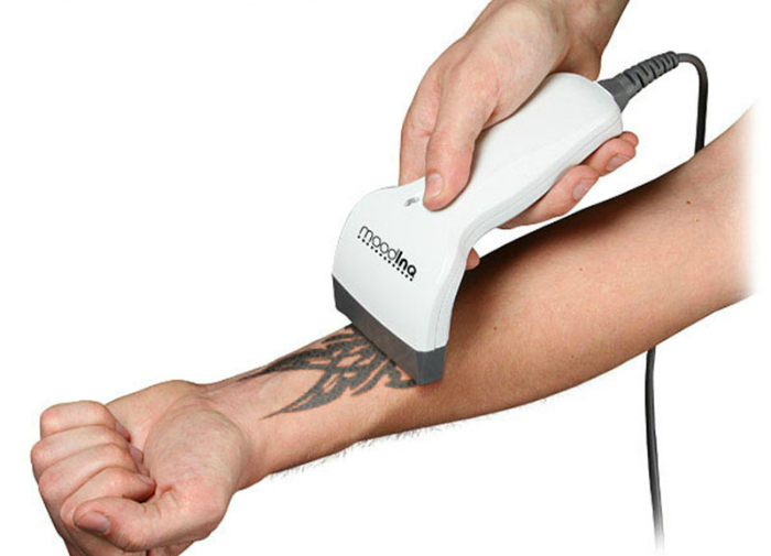 Компактный тату-принтер, который позволит обзавестись несложной татуировкой, не выходя из дома.