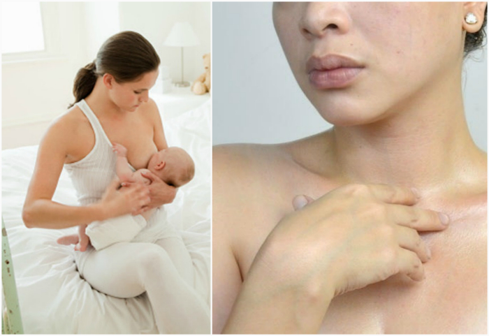 Уход за кожей груди в период грудного вскармливания.