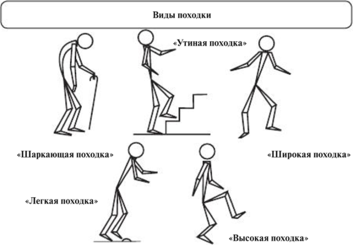 7 привычек, от которых стоит срочно избавиться, чтобы не превратиться в ворчливого старика 