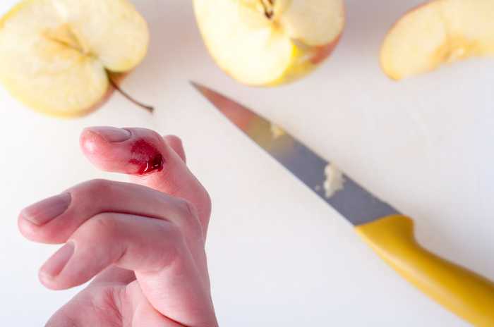 Резать продукты тупым ножом очень опасно. /Фото: healthprep.com