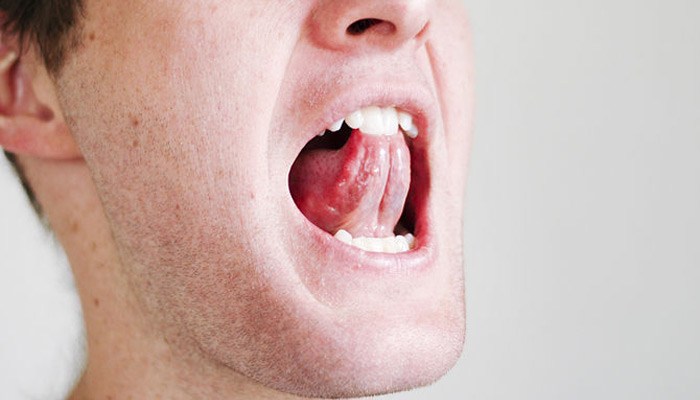 Несколько простых упражнений для горла и языка могут облегчить ситуацию с храпом. /Фото: i2.wp.com