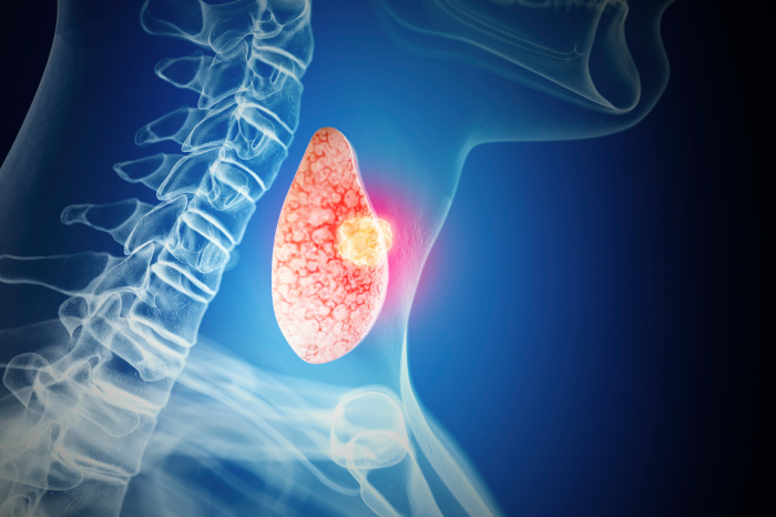 Щитовидная железа может не вырабатывать нужных гормонов, что ведёт в набору веса даже при диете и физнагрузках. / Фото: tvojajbolit.ru