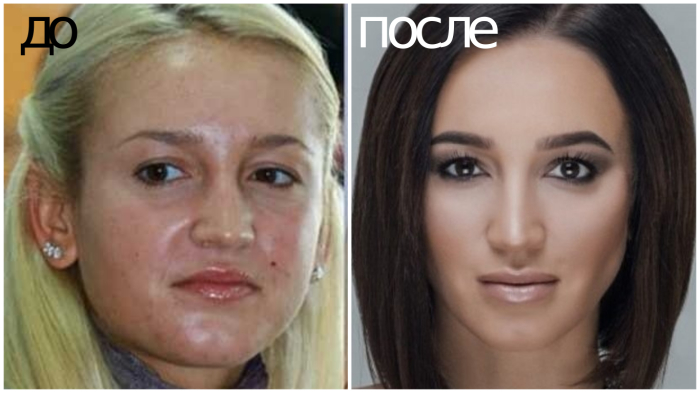 Ольга бузова фото до и после пластики