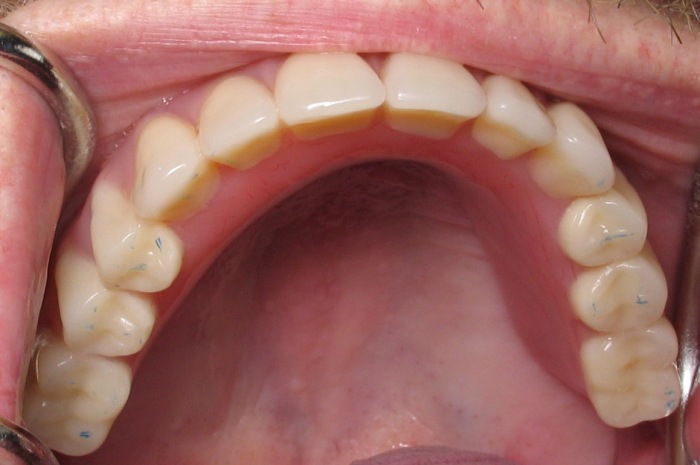 У человека будущего, скорее всего, будет 24 зуба (как на этом фото). / Фото: mavink.com