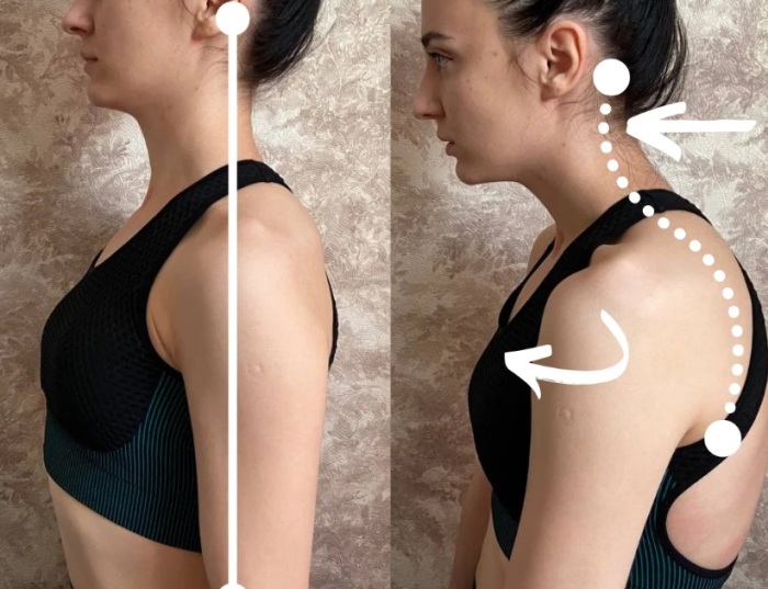 Это очень печальная тенденция. Это очень печальная тенденция.