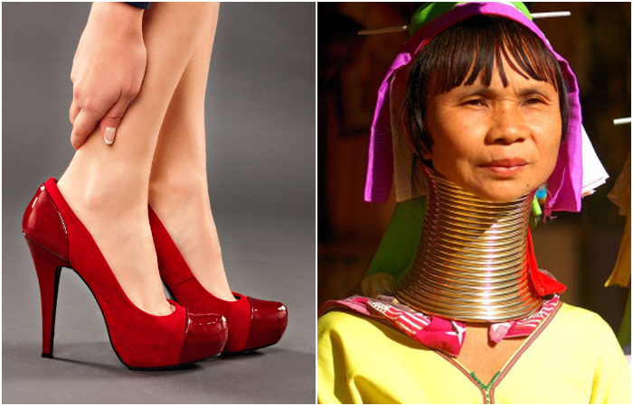 В истории была и остаётся масса опасных для здоровья модных трендов. /Фото: northwichfootclinic.co.uk, neptune-edu.com В истории была и остаётся масса опасных для здоровья модных трендов. /Фото: northwichfootclinic.co.uk, neptune-edu.com