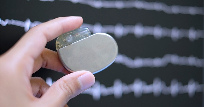 Одна случайная замена детали в устройстве - и миллионы жизней спасены. /Фото: fasda.it Одна случайная замена детали в устройстве - и миллионы жизней спасены. /Фото: fasda.it