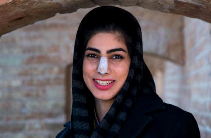 Красота и статус иранской женщины, как ни странно, заключены носике. /Фото: facte.ru