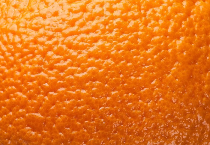 Апельсиновая корка - это не медицинское отклонение, а признак взрослой сформировавшейся женщины / Фото: nemodno.com