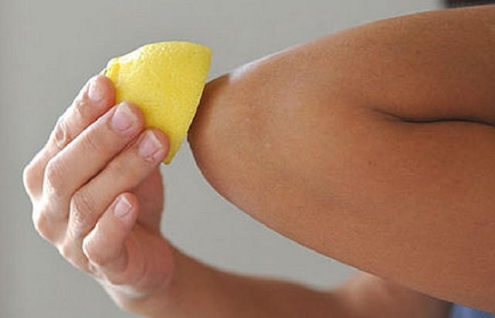 Лимон помогает справиться с сухой кожей локтей / Фото: quaer.ru