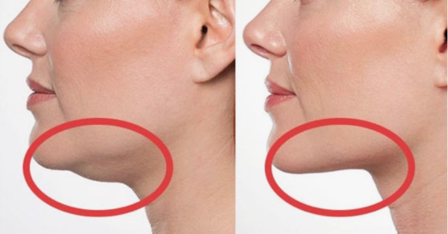 Возрастные изменения. 