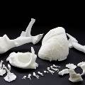Медики напечатали коленные имплантаты на 3D-принтере