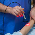 Лазерный «нож» диагностирует рак кожи и тут же лечит его без разрезов