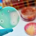 Исследование: дезинфицирующее средство на основе хлора не убивает супербактерий