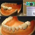 В Тайване создали «умный зуб», который расскажет врачу о привычках пациента