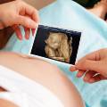 Инновационные технологии: 3d УЗИ при беременности на фото