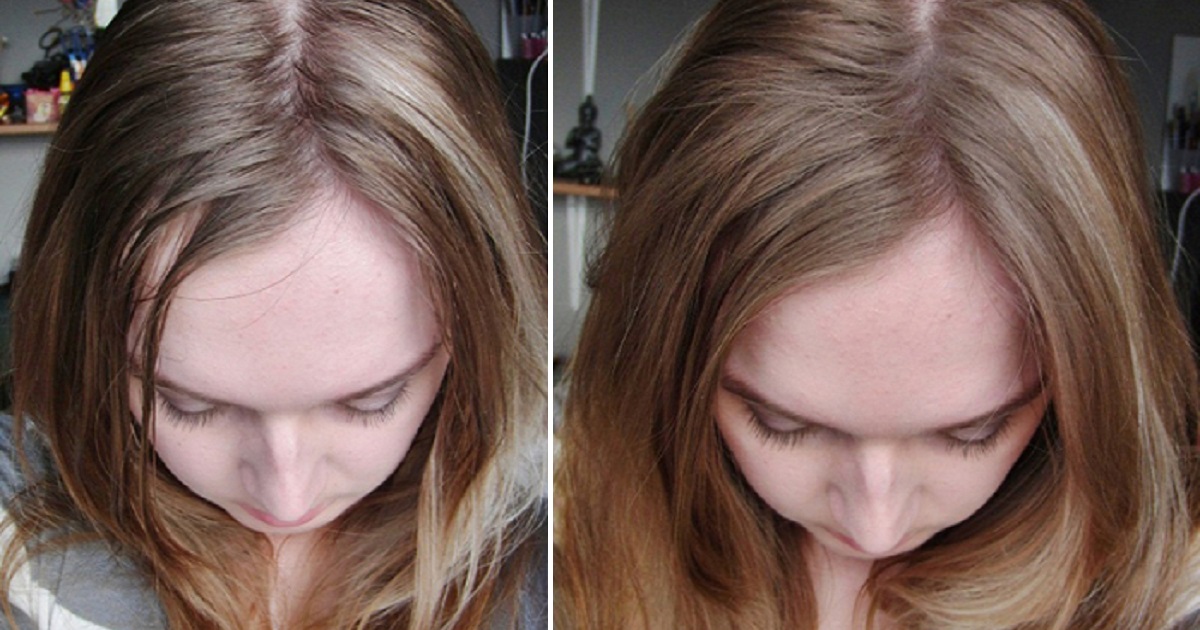 Побочные эффекты после окрашивания волос